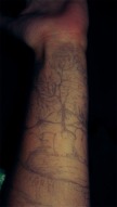 mountains and flowers on my arm 2013